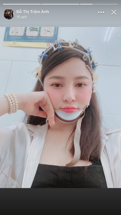 Thậm chí, nhiều người còn ghi lại được hình ảnh Trâm Anh đăng tải trên MXH được cho rằng cô bạn này đã sử dụng đến phẫu thuật thẩm mỹ để sở hữu nhan sắc như hiện tại.