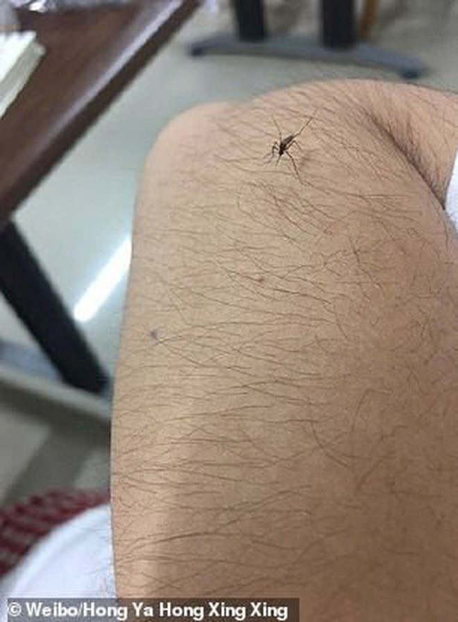 Thậm chí, tại Trung Quốc cuộc thi nuôi lông tay rậm đã được tổ chức. Tuy nhiên, cuộc thi này khiến nhiều người rất bất ngờ vì không nghĩ nó lại biến thành một trend mới.