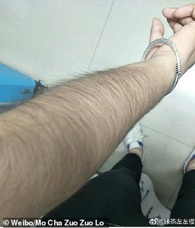 Top 3 bức ảnh có lượng người xem cao nhất sẽ nhận được giải thưởng tương ứng với nhất, nhì và ba là 88 NDT (30.000 đồng), 66 NDT (22.000 đồng) và 55 NDT(18.500 đồng) tiền mặt.