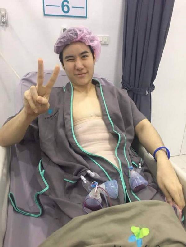 Sau phẫu thuật, anh chàng này sẽ được cố định bằng những miếng bông băng tạo hình. Ngoài ra, họ phải chịu những cơn đau "hành xác" sau khi thuốc thuốc gây tê hết tác dụng.