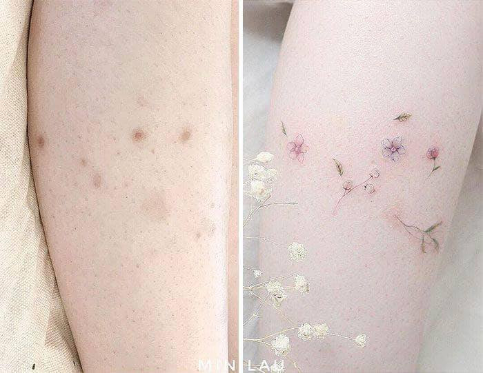Vài vết sẹo thâm sẽ được các thợ xăm biến tấu thành những bông hoa cỏ theo dạng tini cực đẹp và điệu đà.