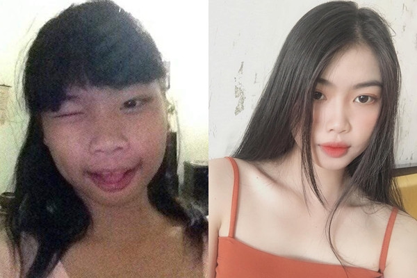 "Dậy thì thành công" không còn là chuyện lạ nhưng thành công đến mức khiến người ta phải nghi ngờ từng phẫu thuật thẩm mỹ thì đúng là câu chuyện dở khóc dở cười.