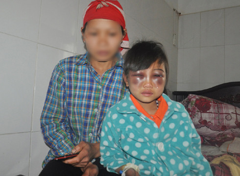 Theo gia đình em T, cô giáo Trà đã bạo hành cháu. Tuy nhiên, cô Trà có đến xin lỗi gia đình. Không ngờ một tuần sau, cô giáo Trà lại tiếp tục đánh cháu lần nữa.
