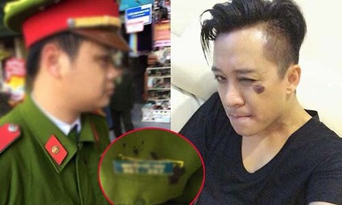 Ca sĩ Tuấn Hưng đánh trật tự phường vì xúc phạm mẹ mình? Trước đó không lâu, trên fanpage Facebook của mình, nam ca sĩ Tuấn Hưng bức xúc kể chuyện bị 2 đồng chí công an trẻ cùng trật tự phường giữ xe. Song đáng chú ý hơn, Tuấn Hưng cho biết đã đánh cán bộ trật tự phường vì xúc phạm mẹ mình. Tuấn Hưng chia sẻ, do vội vã chạy lên nhà đón con đi dạo phố, anh đã đỗ xe không đúng chỗ và bị hai đồng chí công an trẻ cùng lực lượng trật tự phường giữ xe. Dù Tuấn Hưng trình bày hoàn cảnh và mong sự vị tha nhưng hai anh công an trẻ không bỏ qua.