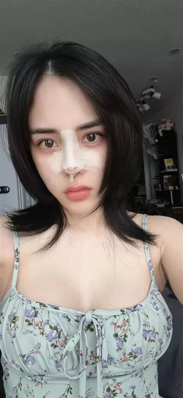 Có thể thấy, trải qua 3 lần thẩm mỹ, có lẽ Bạch Lan Phương vẫn chưa hài lòng về nhan sắc hiện tại của mình.