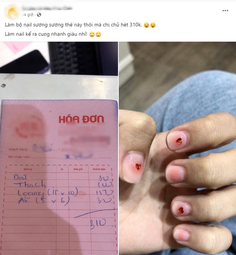 Cách đây chưa lâu, một cô gái đã bức xúc đăng tải về câu chuyện đi làm nail của mình. Dù mức giá cuối cùng thanh toán không hề rẻ, thế nhưng kết quả cô nàng lại nhận được thì không như ưng ý, khá nham nhở.