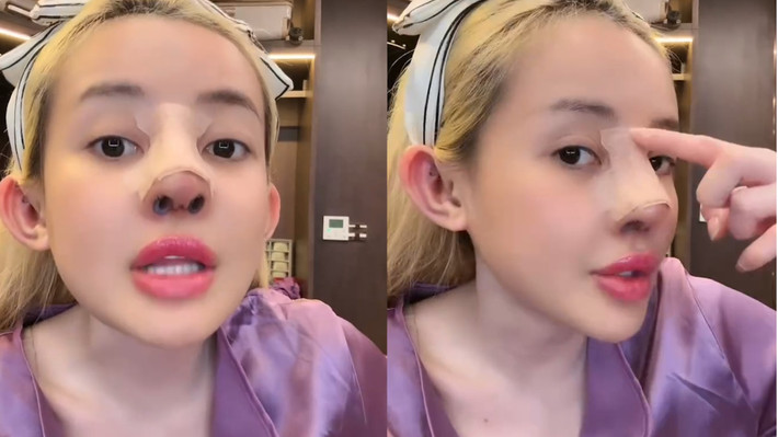 Nhiều netizen còn cho rằng bạn gái Lương Bằng Quang đã "nghiện" chuyện dao kéo.