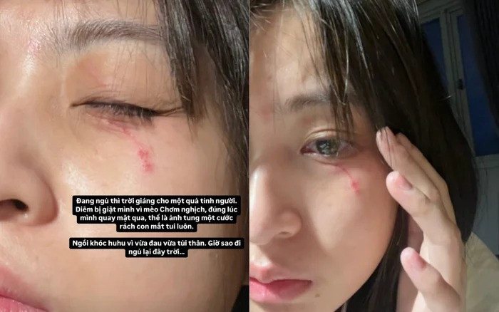 Nguyễn Lâm Thảo Tâm cho biết trong lúc ngủ, hai chú mèo cưng đang trêu đùa đúng lúc cô quay mặt qua, vì vậy cô đã bị một chú mèo còn lại cào vào mắt.
