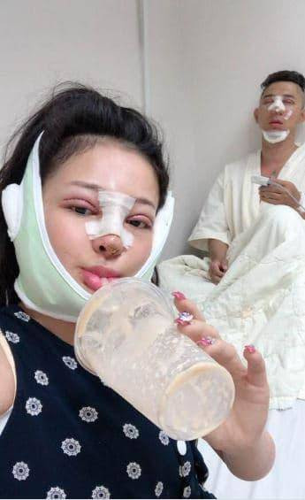 Thay vì thời điểm đó, nữ DJ phải điều trị dứt điểm xong mới làm mũi giả nhưng vì nôn nóng “muốn làm lại đẹp liền luôn nên giờ viêm bị tái lại”.