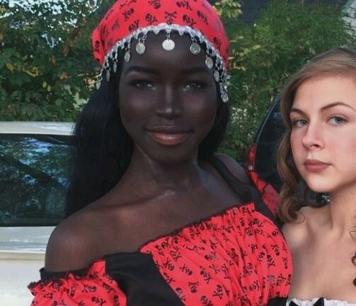 Lola Chuil (17 tuổi, sống tại New York, Mỹ) nổi tiếng trên mạng từ năm 2016 nhờ làn da khác biệt cùng gương mặt xinh xắn như búp bê.