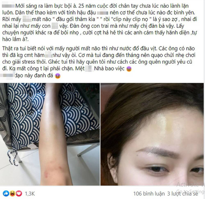 Chia sẻ về lý do bị thương, Trâm Anh cho biết do cô vận động thể dục - thể thao nhiều kết hợp tính tình hậu đậu nên mới dẫn đến việc xuất hiện những vết bầm kia.