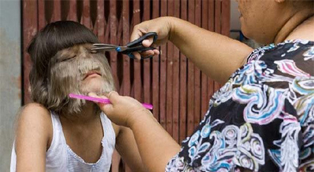 Thế nhưng, một điều đáng buồn khi đến nay các nhà khoa học trên thế giới vẫn chưa tìm ra nguyên nhân gây ra loại bệnh "người sói".