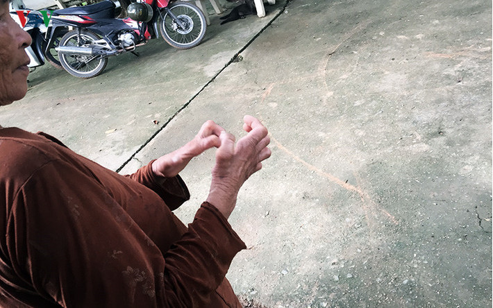 Căn bệnh phong quái ác vẫn đeo bám, tiếp tục hành hạ các cụ.