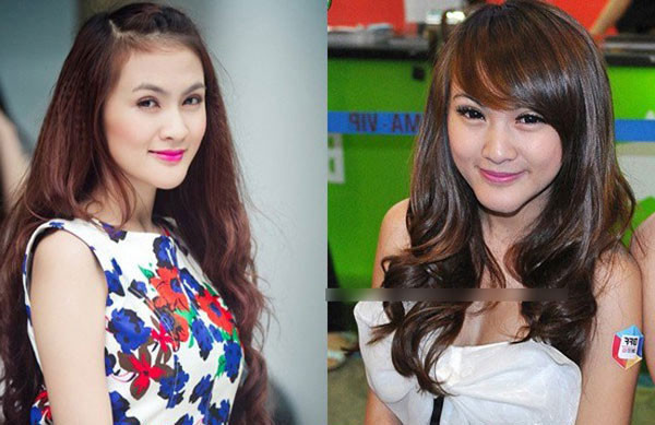 Hiện tại, gương mặt cô đang có những dấu hệu phù nề và các biểu cảm cũng trở nên khó khăn hơn. Công chúng cho rằng, cô đang dần gánh chịu hậu quả của việc lạm dụng dao kéo.