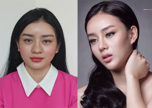 Khi chưa nhờ tới dao khéo, khuôn mặt của Angela Minh Châu khá tròn với chiếc mũi to, mắt bé (trái). Vì muốn có được diện mạo gợi cảm như Phạm Băng Băng, cô đã quyết tâm đầu tư cho thẩm mỹ nhằm thay đổi hoàn toàn gương mặt.