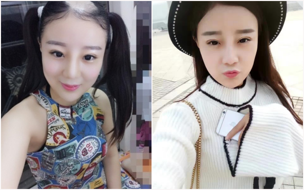 Lưu Kiều Kiều hiện tại đang học tập và sinh sống tại Bắc Kinh. Sau tai nạn từ trào lưu ăn ngô bằng máy khoan, cô nàng này mất nguyên mảng tóc trên đỉnh đầu khiến nhan sắc của cô giảm sút đáng kể và phải thêm phụ kiện để che đi vệt "hói" của mình.