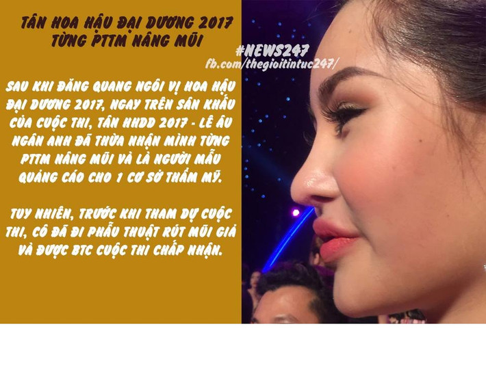 Để được tham gia cuộc thi Ngân Anh đã phải rút mũi giả nhưng đôi môi "tều" vẫn là chủ đề để cư dân mạng soi mói.