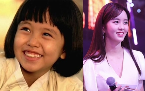 Ở tuổi 20, mỹ nhân Hàn Kim So Hyun khiến người ta kinh ngạc bởi nhan sắc tựa nữ thần, trong khi ngày bé, cô đen nhẻm, kém sắc, thừa nhận chẳng có ai khen xinh đẹp.