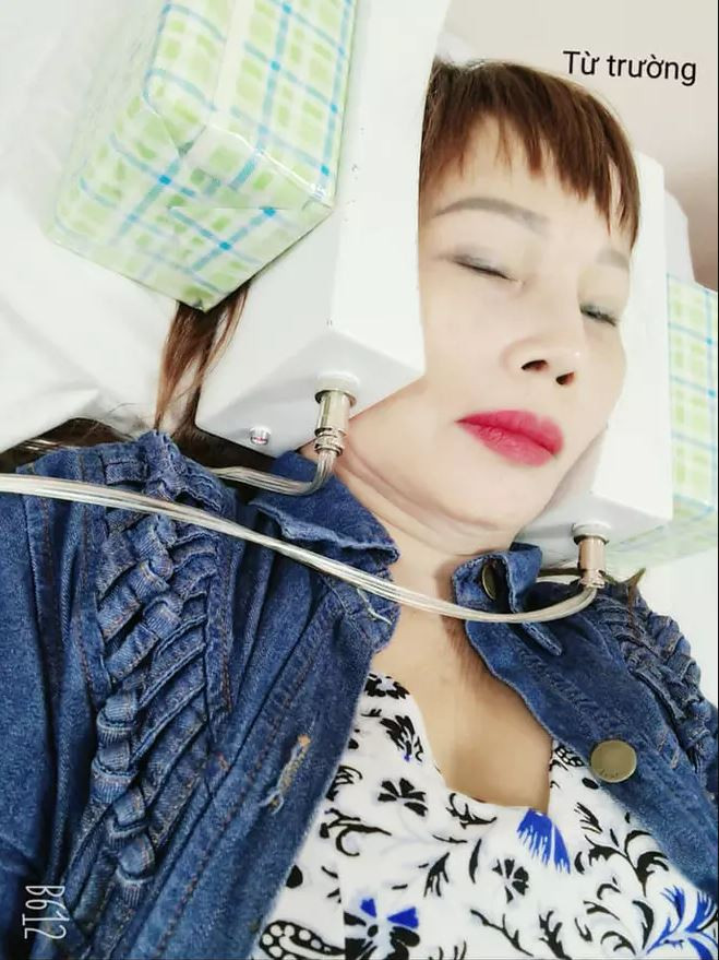 Mắt cô dâu Cao Bằng bị sụp hẳn một bên trong khi miệng có chút méo, lệch. Nhưng bù lại, nhiều người nhận xét người phụ nữ này khá trẻ trung dù bước vào tuổi U70.