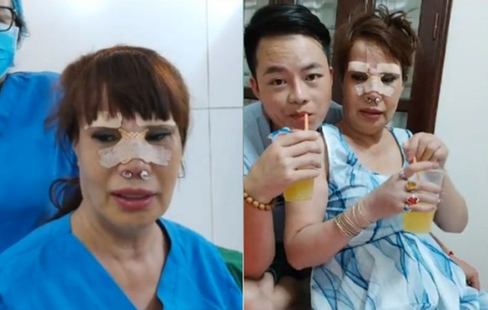 Tuy nhiên, số khác lại nhận định Thu Sao từng đụng chạm thẩm mỹ, vì vậy rất có thể khuôn mặt lạ lẫm như hiện tại là thành quả của quá trình trùng tu vất vả từ những năm trước.