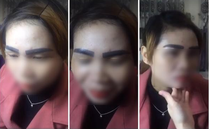 Cô gái này thì lại khốn khổ vì cặp lông mày như “nhọ nồi”. Lông mày khi chưa xăm còn đẹp hơn gấp nhiều lần.