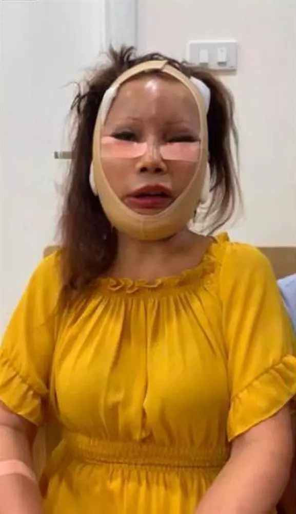 Khi ấy, cô dâu Thu Sao vừa trải qua cuộc phẫu thuật dài, nằm trên giường bệnh với gương mặt sưng phù, nhợt nhạt.