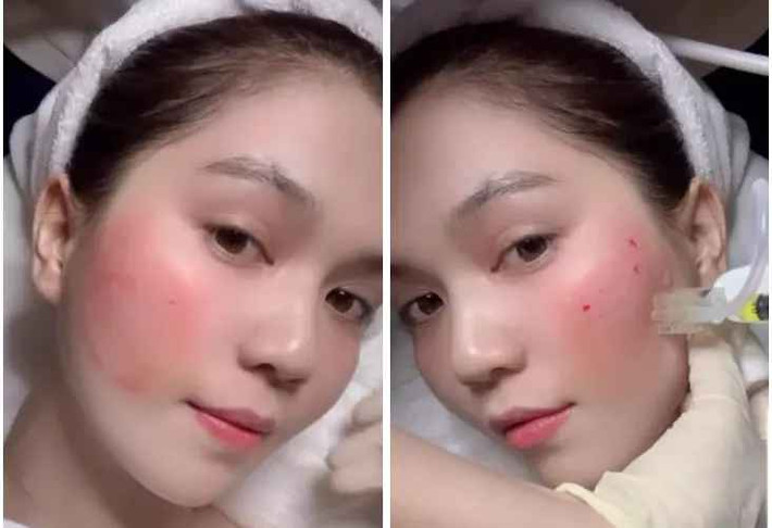 Bên cạnh đó, người đẹp trong làng showbiz Việt phủ nhận phương pháp vô lý như thay máu - lột da mà nhiều người suy đoán.