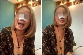 Rất nhiều bình luận bày tỏ thái độ tức giận khi chính bị người phụ nữ trêu đùa lố bịch: "Cố tình kiếm thêm ít tương tác ấy mà. Muốn nổi tiếng lắm rồi", "Nhìn quả mũi gập đôi mà ám ảnh", "Giờ còn có cả chiêu lừa người tinh vi thế này ư? Ngán ngâm chiêu câu like rẻ tiền"...