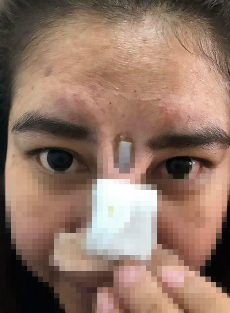 Phẫu thuật thẩm mỹ ngày này rất phổ biến. Với mong muốn cải thiện nhan sắc, nhiều người tìm đến các bệnh viện thẩm mỹ để trùng tu diện mạo.