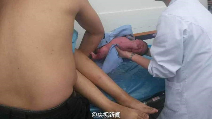 Xu ChunPeng đã đỡ đẻ thành công. (Nguồn: CCTV).