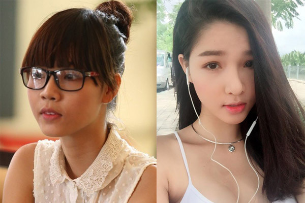 Hồi mới vào nghề, nhan sắc của Kỳ Hân không có gì nổi bật vì hàm răng cô khấp khểnh không đều, sống mũi tẹt lại chưa biết cách ăn mặc, trang điểm phù hợp nên hình ảnh " tình mới của Mạc Hồng Quân" lúc đó khá mờ nhạt, không thể tạo thành điểm nhấn trong giới người mẫu showbiz Việt.