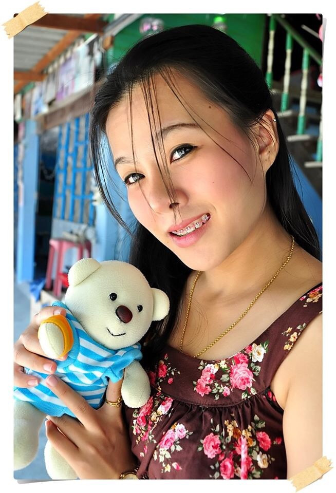 Sống mũi cao giúp khuôn mặt của Stan trở nên thanh thoát hơn nhiều so với trước đây.