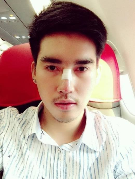 Vẻ đẹp trai của một hot boy sang chảnh dần dần hiện ra trên khuôn mặt của Palm, chàng trai trước đó xấu xí và đen nhẻm.