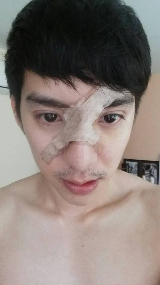 Để tự giúp mình thoát khỏi những tự ti về hình thể cũng như khuôn mặt Paya đã quyết định tới Hàn Quốc để phẫu thuật thẩm mỹ để có một khuôn mặt mịn màng cùng hàm răng thẳng tắp.