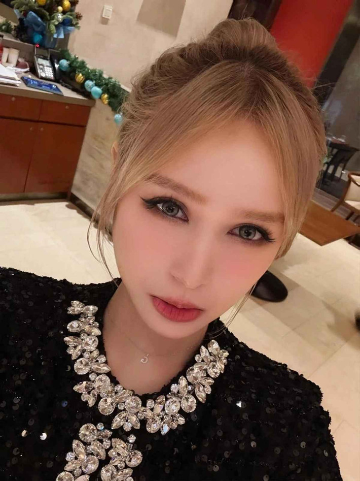 Dòng chia sẻ tin không vui của Xoài Non thu hút đông đảo sự quan tâm từ khán giả. Nhiều người đã bình luận thăm hỏi hot girl đồng thời chia sẻ kinh nghiệm "đối phó" với chiếc răng khôn.