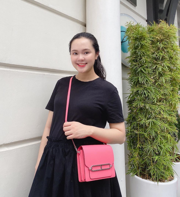 Có thể thấy Quỳnh Anh đang trải qua giai đoạn cuối thai kỳ với đủ những vết tích y hệt các bà mẹ khác: từ vết rạn mờ mờ, cho đến phù nề mặt mũi chân tay, cơ thể bắt đầu nặng nề hơn khi bụng to dần.