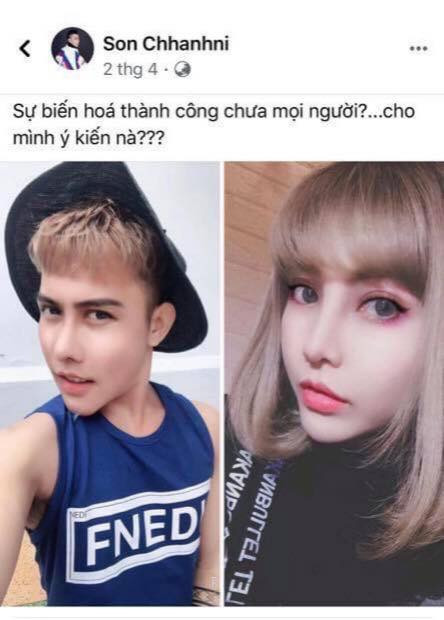 Bẵng đi một thời gian dài, người ta lại thấy tài khoản Facebook của thảm họa mạng Tùng Sơn chia sẻ hình ảnh mới của anh chàng hậu phẫu thuật thẩm mỹ.