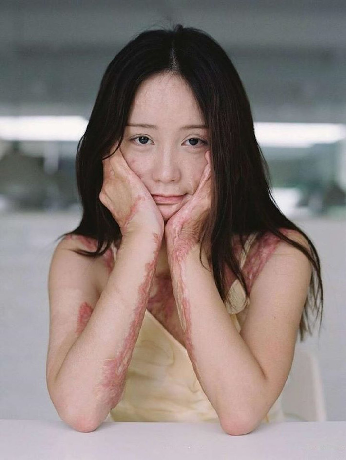 Trong số những người chạy theo Châu Nham có Đào Nhữ Khôn, một cậu thiếu gia nhà giàu ngỗ ngược. Cậu ta công khai theo đuổi nữ người mẫu trẻ tuổi teen nhưng cô luôn thể hiện sự từ chối.