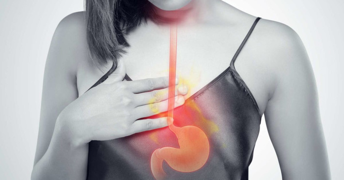 Ợ chua thường xuyên: Cảm giác nóng rát, khó chịu ở ngực thường gặp ở người lớn tuổi và có thể được điều trị bằng thuốc không kê đơn. Nhưng nếu chứng ợ nóng thường xuyên và ngày càng trầm trọng hơn hoặc không đáp ứng với thuốc, bạn có thể mắc bệnh trào ngược dạ dày thực quản (GERD), chứng rối loạn trong đó van giữa dạ dày và thực quản không đóng đúng cách. Nếu không được điều trị, GERD có thể dẫn đến các biến chứng bao gồm xói mòn hoặc thu hẹp thực quản, hoặc tình trạng tiền ung thư là Barrett thực quản. Trong một số trường hợp hiếm, chứng ợ nóng nghiêm trọng cũng có thể là dấu hiệu của ung thư thực quản hoặc thoát vị gián đoạn. Ảnh: Medicalnewstoday.