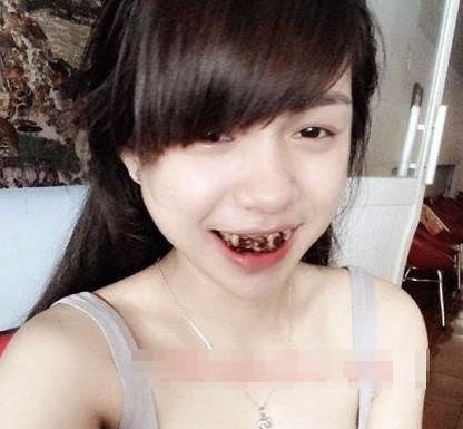 Hết làm mắt xấu, các cô gái lại chuyển sang làm miệng, răng xấu. Nhiều bức ảnh bình thường khiến người nhìn "thấy gớm" nhưng nó lại đặc biệt "hot" trên mạng bởi tính hài hước.