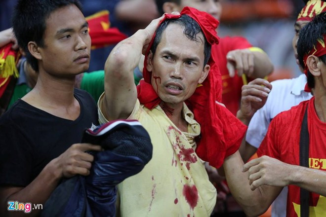 Quá tức tối vì bị lội ngược dòng, một số CĐV Malaysia đã không giữ được bình tĩnh và có hành động quá khích, họ tràn sang đánh đập CĐV Việt Nam làm nhiều người bị thương. Ảnh: Zing.