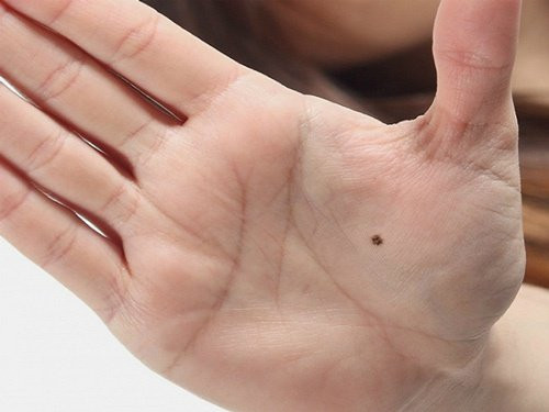 Nốt ruồi trong lòng bàn tay. Trong nhân tướng học, phụ nữ nào sở hữu nốt ruồi trong lòng bàn tay thì xác định đó là những người thông minh và mang mệnh phú quý.