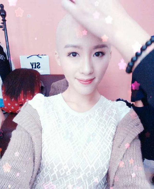 An Nhiên tên thật là Dương Miểu, 25 tuổi, là người Hắc Long Giang. Được biết cô gái xinh đẹp này mắc bệnh di truyền trong gia đình nên tóc không thể mọc được.