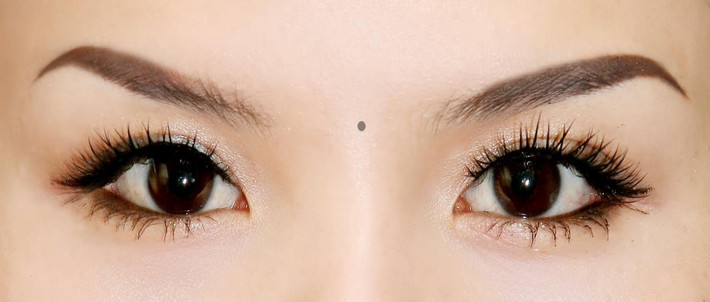 Nếu ở đây có nốt ruồi ác thì cuộc sống hôn nhân của người như vậy thường không được như ý, về nhiều mặt thường mang lại những bất tiện khác nhau cho cuộc sống của bạn sau khi kết hôn.