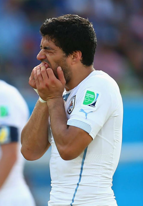 Nực cười hơn, sau khi cắn Chiellini, Suarez còn ôm miệng và tỏ ra rất đau đớn. Đây là một chiêu tiểu xảo xấu xí của tiền đạo này, anh cắn Chiellini để hậu vệ tuyển Italy có phản kháng, vung tay ra đằng sau đập vào mặt mình và sau đó ăn vạ.