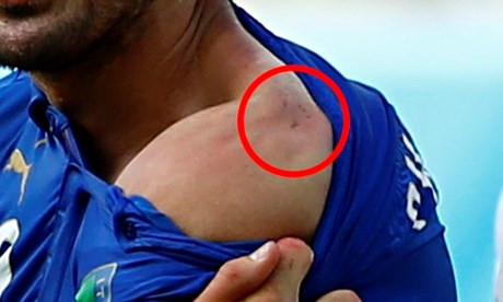 Trong trận đấu giữa hai đội tuyển Italy và Uruguay, khuôn khổ vòng 3 bảng D World Cup 2014, ở một pha hãm thành Luis Suarez, tiền đạo của Uruguay đã cắn vào vai Giorgio Chiellini, hậu vệ tuyển Italy. Hành động này được camera ghi lại rất rõ và Chiellini cũng "khoe" được vết răng của Suarez hằn trên vai mình. Nhưng trọng tài điều khiển trận đấu đã bỏ qua lỗi này cho Suarez.