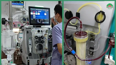 Đau bụng, nôn mửa điều trị tại nhà người đàn ông 67 tuổi bị nhiễm khuẩn huyết