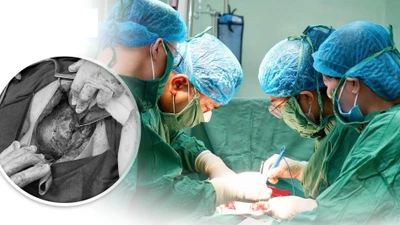 Bảo tồn tử cung cho sản phụ mắc rau cài răng lược thể nặng