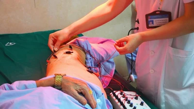 Đau zona thần kinh biến chứng nguy hiểm thần kinh, giác quan