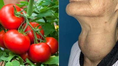 Bị bệnh tuyến giáp có nên ăn cà chua?